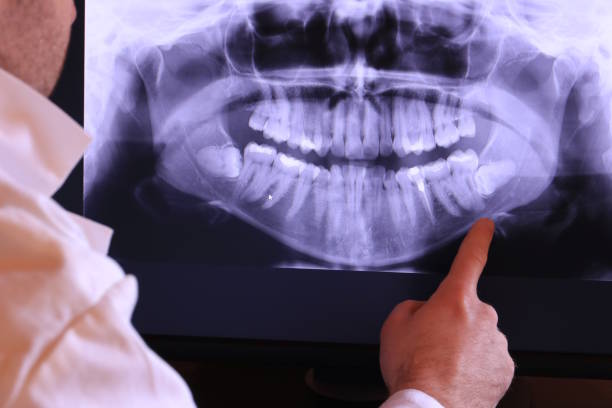 Best Pediatric Emergency Dentist in Chenango Bridge, NY
