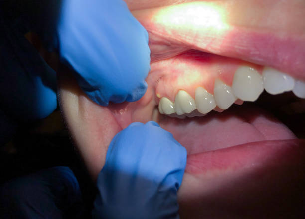 Best Emergency TMJ Treatment in Chenango Bridge, NY