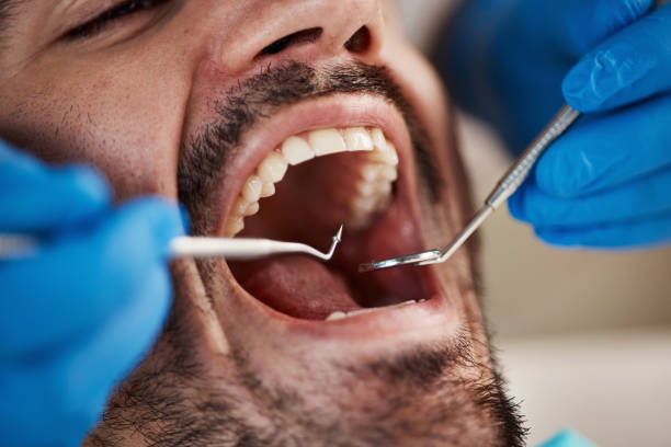 Best Pediatric Emergency Dentist in Chenango Bridge, NY
